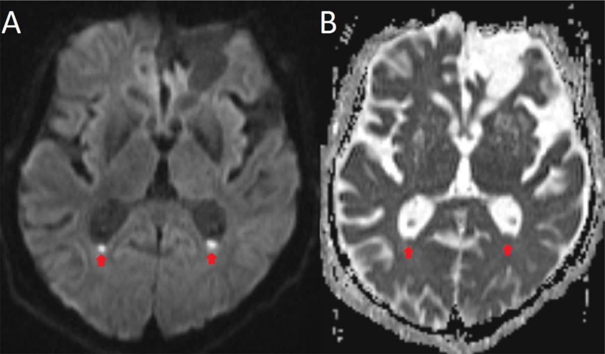 Journal of the Belgian Society of Radiology. 2020;104(1):13....